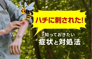 ハチに刺されたら？症状と対処法
